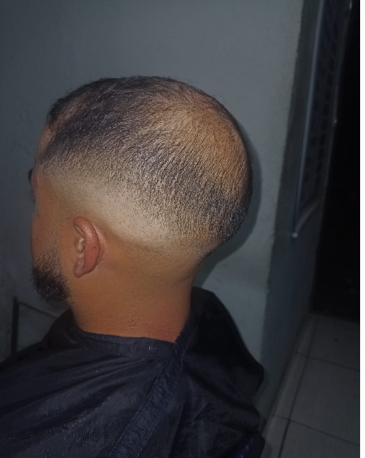 Navalhado com Degradê na Barba